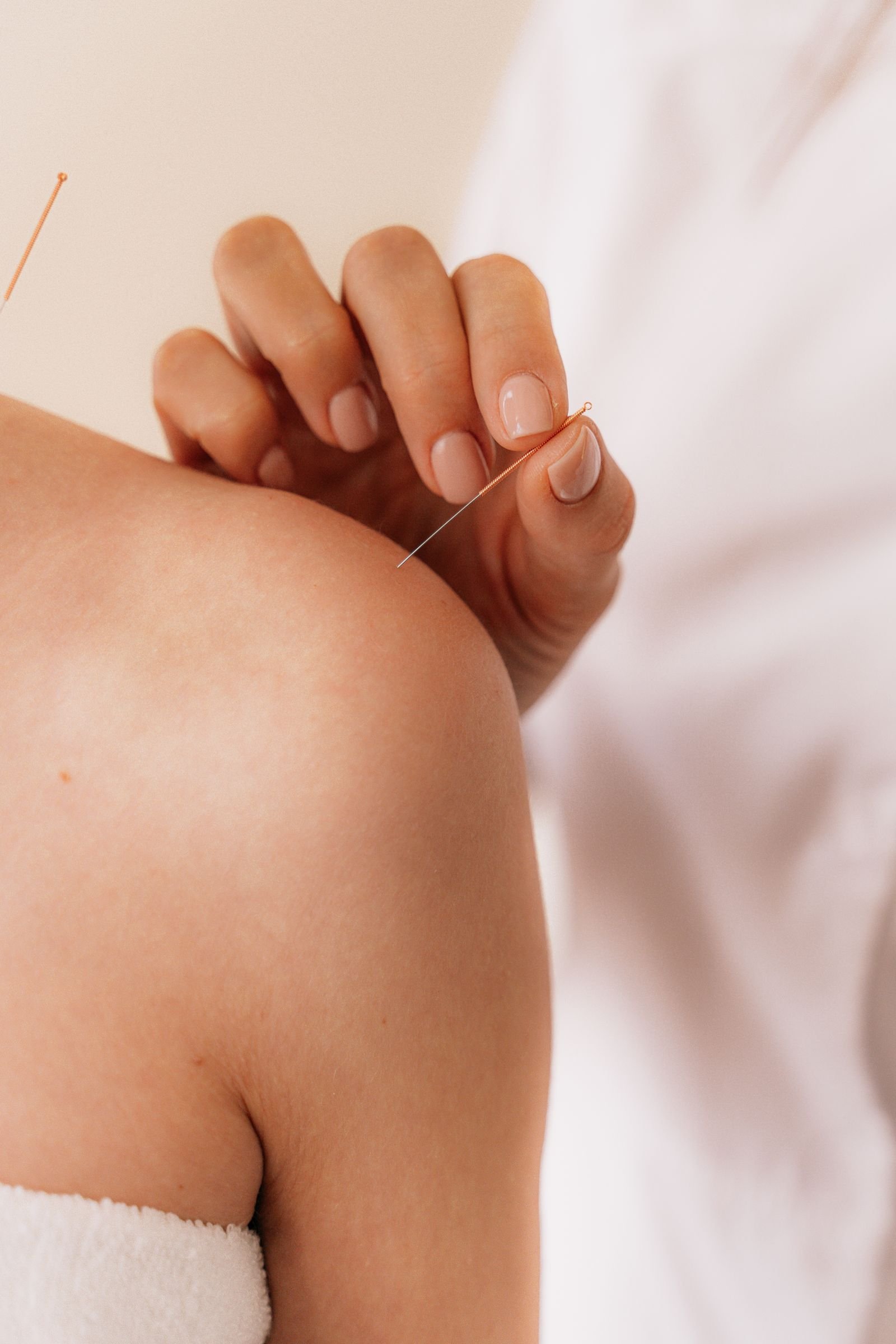 Dry Needling eli kuivaneulaus Helsingissä